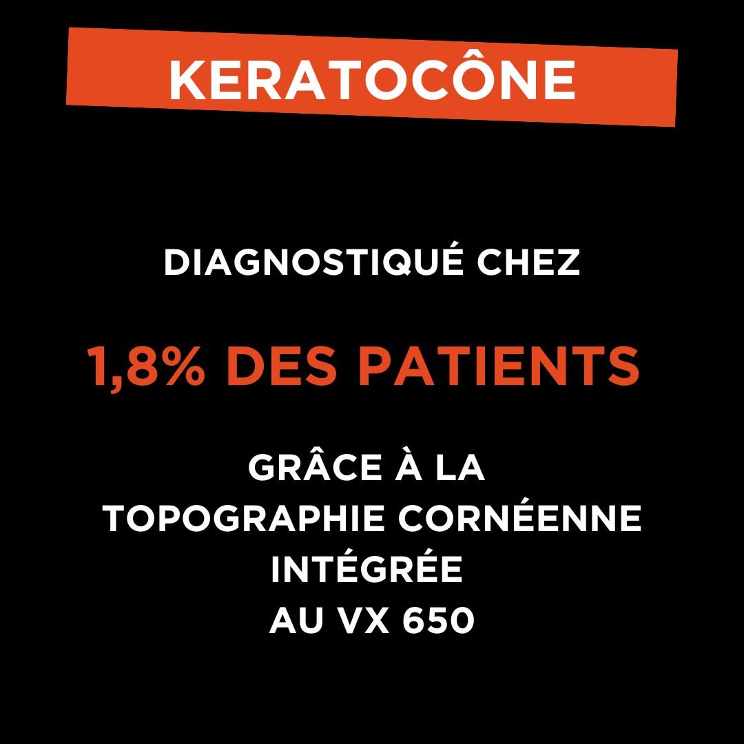 Keratocone