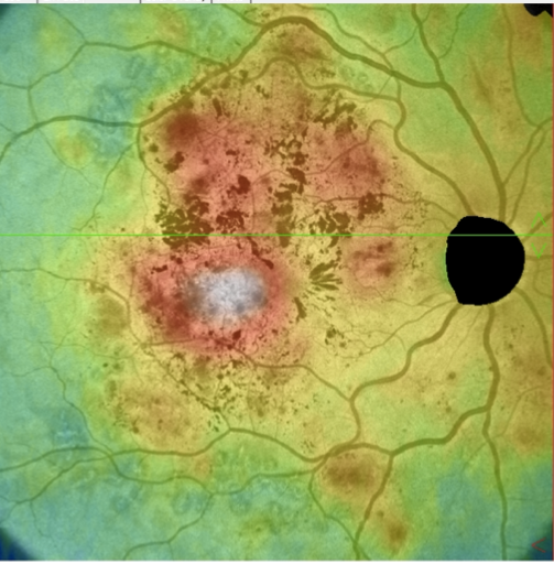 pic4 - Retina protocol