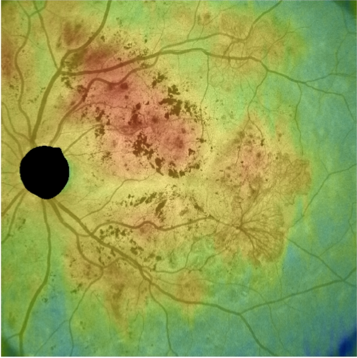 pic6 - Retina protocol